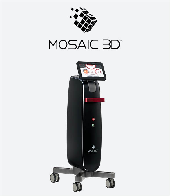 mosaic3d_productfeaturev3-2